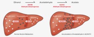 This Is How It Works - Alcohol Flush