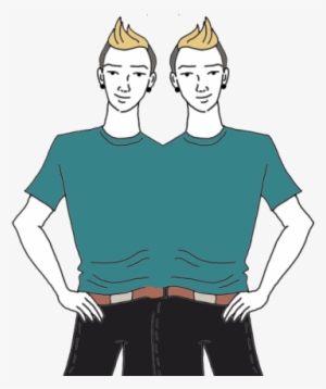 Siamese Twins - Conjoined Twins