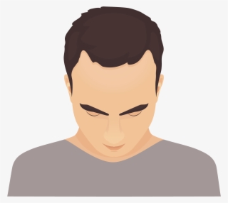 Phase 1 Of Baldness Is Recognized By The Presence Of