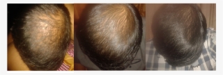 Dermatologist In Chennai