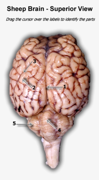 Superior View Of Sheep Brain - Sheep Brain Superior View