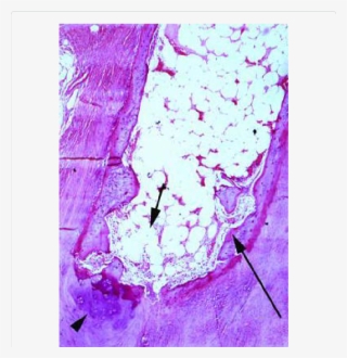 Higher Magnification Of Figure 1 Showing The Spongy - Creative Arts