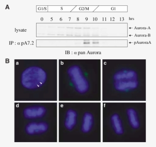 Restricted Thr288 Phosphorylation Of Human Aurora-a - Thymidine