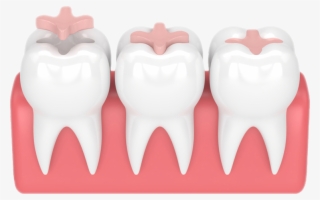 More Info - Tongue