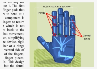 Design Of The Prosthetic Head - Diagram