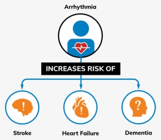 Irregular Heart Rhythms Increase Your Risk Of Stroke - Diagram