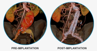 3d Reconstruction Images Courtesy Of Dr - Freshwater Crab