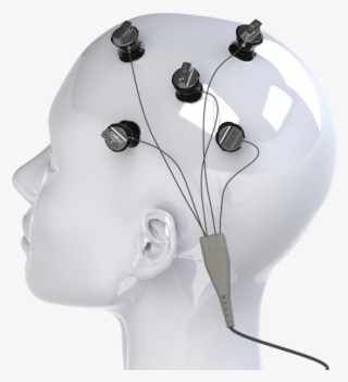 4x1m1 Hd Small - Multi Channel Tdcs