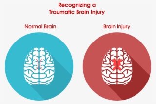 Imagine You've Got An Extremely Big And Elaborate Jigsaw - Normal Brain Vs Injured Brain