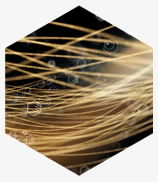 Causes Of Hair Loss In Women - Hair