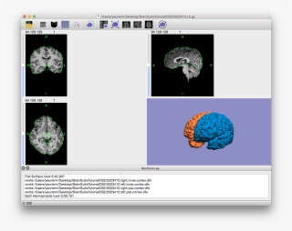 Final Output Of Cse, With Cross-hairs Off And Volume - Circle