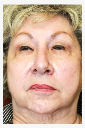 0031 Img - Portrait Photography