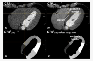 A) Registered Image Ct A (ela) Obtained With The Ssd[·] - Computed Tomography