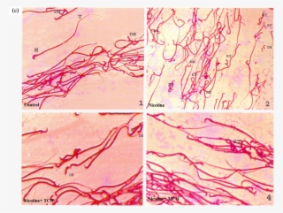 Effect Of Cosupplementation Of Tender And Mature Coconut - Art