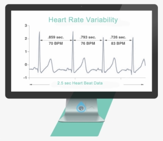 Hrv Explaination - Diagram