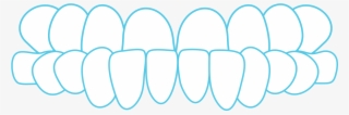 Underbite - Circle