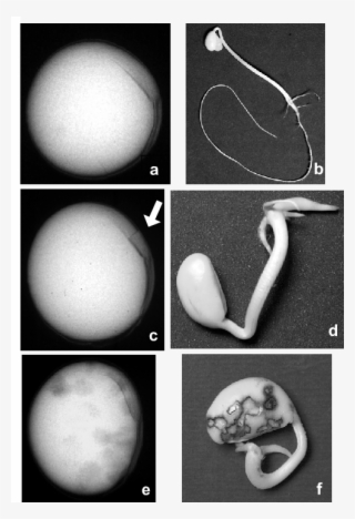 Soybean Seed Images Obtained By X-ray Test And Related - X Ray Seed Test