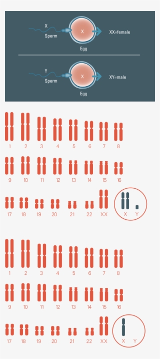 Chromosome Conditions Chromosome Conditions - 転 座 型 ダウン症