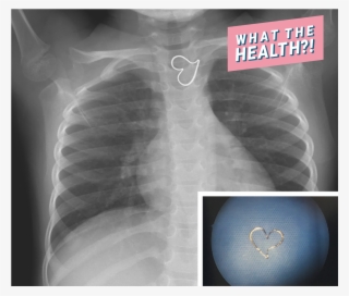 X-ray Heart Medical Doctor Hospital Found Woman Health - Heart