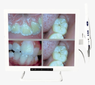 Flat Panel Display