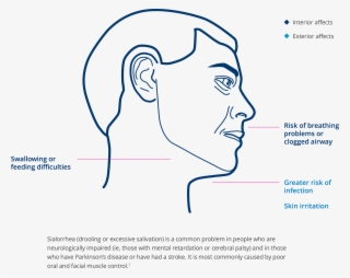 References - Diagram