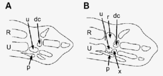 Embryonic Chicken Wing Bud At - Drawing