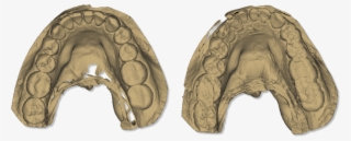 File - Maestro - 3d - Easy - Dental - Scan - Calibration - Scanner 3d Dentale