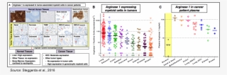 Arginase Expression 2 - Arginase 1 In Tumors