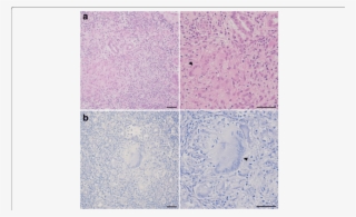 A Hematoxylin And Eosin Staining - Tile