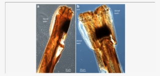 Skin Piercing Machinery-light Microscopy - Medical Imaging