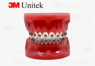 3m Espe