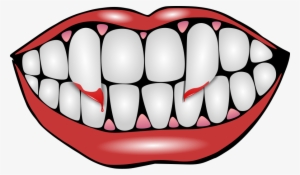 Lips Vector Vampire - Halloween Teeth Clipart