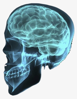 X-ray Png Transparent Image - Brain X Ray Transparent