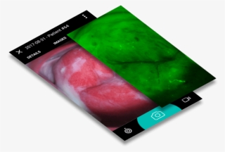 Mobileodt Tech Talk - Gadget