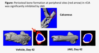 Schett G, Arthritis Rheum, - Art