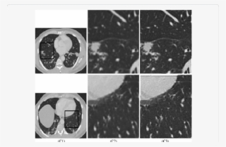 Processing Naturally Blurred Ct Images - Monochrome