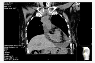 (b) (c) - Radiology