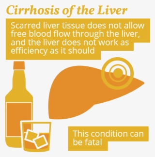 Cirrhosis And Alcohol Use