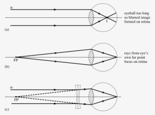 Diagrams Cbse Class Class X Physics Light Reflection - Short Sighted Ray Diagram