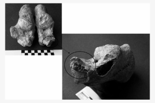 Left And Right Calcanei Of The Adult Female Skeleton - Monochrome