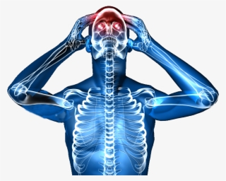 Define Headaches - Headache