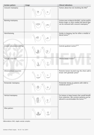 Mastopexy Incision Patterns - Mastopexy