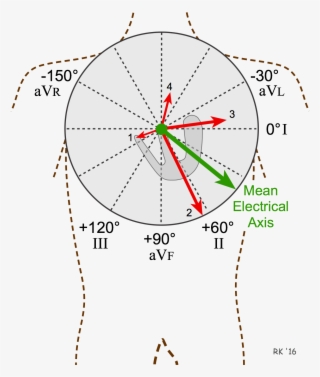 Ecg Electrical Mean Axis - Diagram