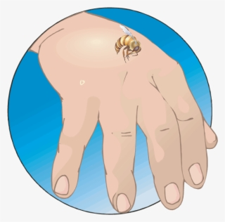 Bees Do Not Sting As An Aggressive Act - Bee Stings Allergic Reactions