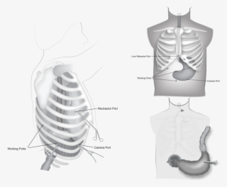 Stomach - Rib