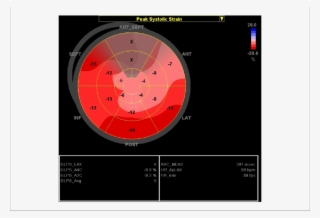 Bull's Eye " View Of The Longitudinal 2d Strain Of - Circle
