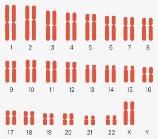 Chromosomes - Turner Syndrome Karyotype Chart