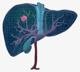At The Global Liver Tumor Segmentation Challenge That - Butterfly