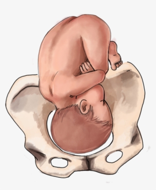 Roa Baby Position - Frank Breech