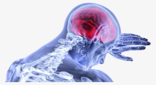 Concussion Brain Png